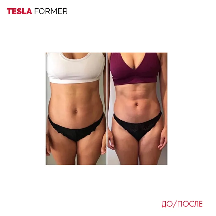 Tesla Former — аппаратная коррекция фигуры — пример 3